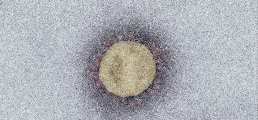 SARS-Coronavirus-2 (SARS-CoV-2, Isolat SARS-CoV-2/Italy-INMI1). Elektronenmikroskopie, Negativkontrastierung (PTA). Maßstab: 100 nm (Foto: Robert-Koch-Institut)